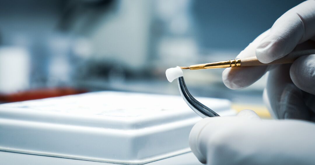 What’s the Difference Between Dental Crowns and Veneers?